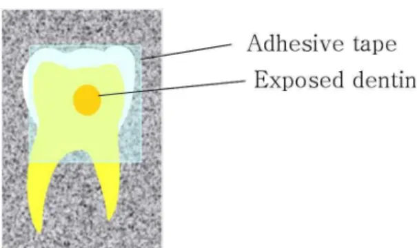 Fig. 1. Schematic draw of prepared tooth specimen