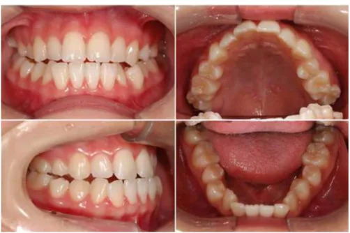 Fig. 1. Initial intraoral photo.