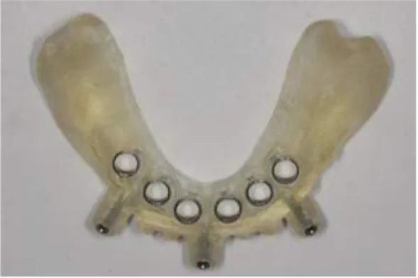 Fig. 3. Three dimensional image-based treatment planning software(Procera software;