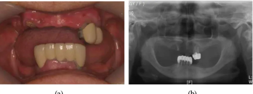 Fig. 1. Initial intraoral photo(a) and Panoramic view(b).