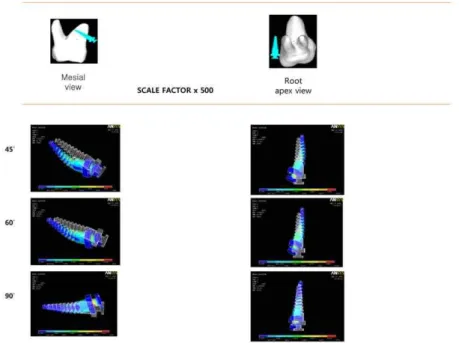 Fig. 9. Displacement of the OMI (500 times magnified). White color is before, and blue is after force application on the OMI.