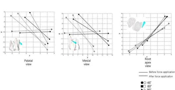 Fig. 10. Graph for displacement of OMI from center of the head to screw end tip (1000 times magnified)