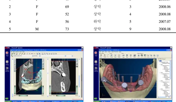 Fig. 1. Simulated 3D imaging in Procera ® program (Patient 4).