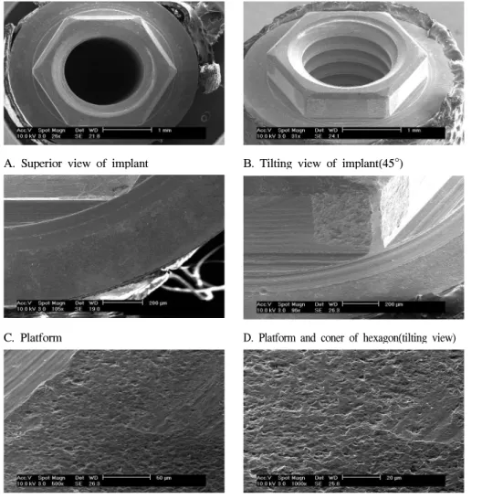 Fig. 3. Photomicrograph of Osstem Implant attached to cemented (titanium) abutment in SEM (A,B,C,D,E,F; Magnification ×21, ×24, ×105, ×96, ×500, ×1000) 결 과 1