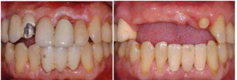Fig. 1. Initial intraoral status