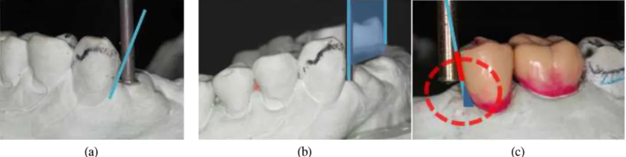 Fig. 12. (a) Different vertical position of rigid retainer