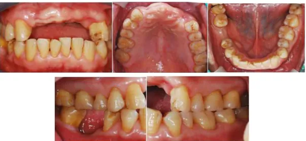 Fig. 13. Initial intraoral status