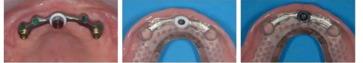 Fig. 10. connection of male-female part in the mouth.