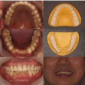 Fig. 1. Intraoral overview