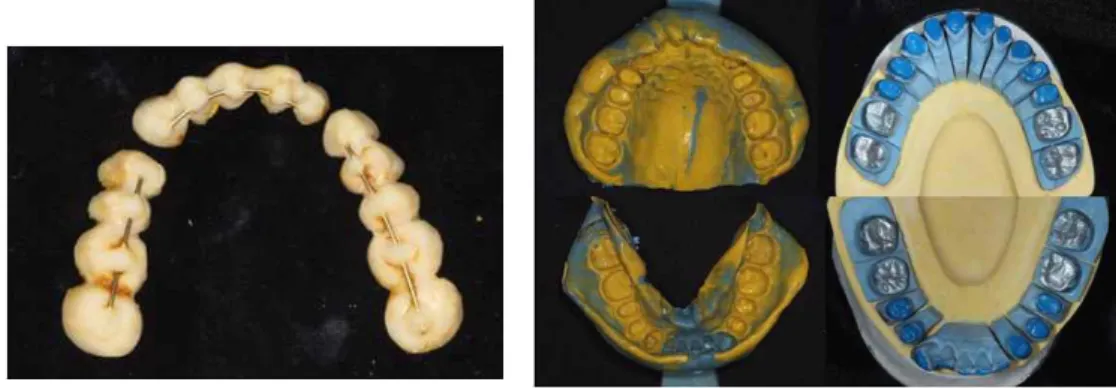 Fig. 4. Making the master impressions