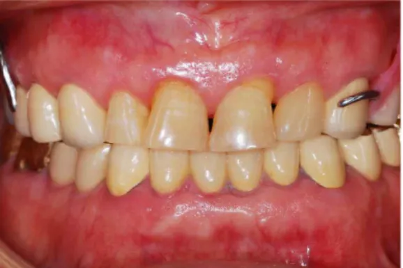 Fig. 8. Final restoration frontal view.