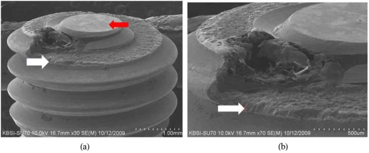 Fig. 7. Side view of the fractured implant fixture. (a) Low magnification (X 30, white arrow indicates sound implant retaining screw)