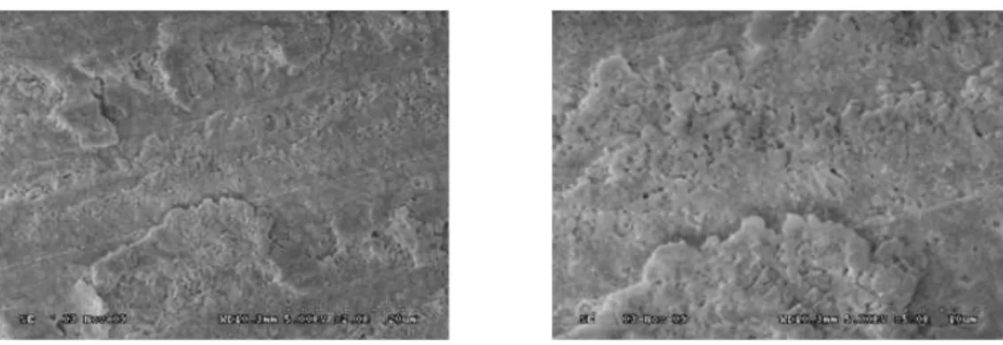 Fig. 7. 30μm Cojet sand 4초(2K)(5K). 많은 양의 sand particle과 고른 거친 표면을 나타내고 있다.
