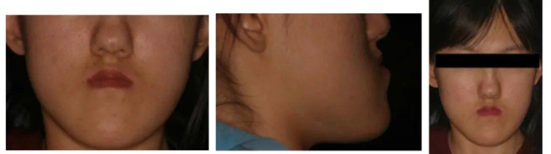 Fig. 1. Initial Extraoral views