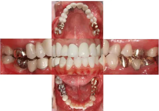Fig. 2. Frontal view of face showed asymmetric deviation of mandible to the left