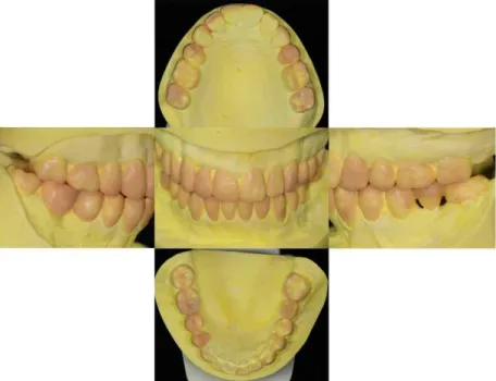 Fig. 9. Diagnostic wax-up.