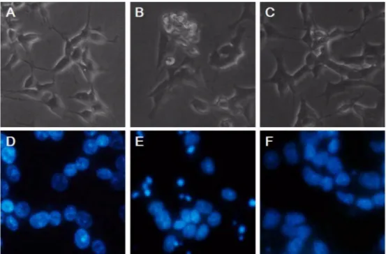 Fig. 2.  Morphological assessment of apoptosis by phase-contrast and fluorescence microscopy.