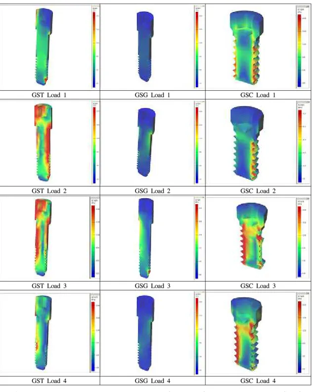 Fig. 10. The stress contours of the abutment screw(GST, GSG) and the cylinder screw(GSC) in model under loading condition 1, 2, 3, 4.