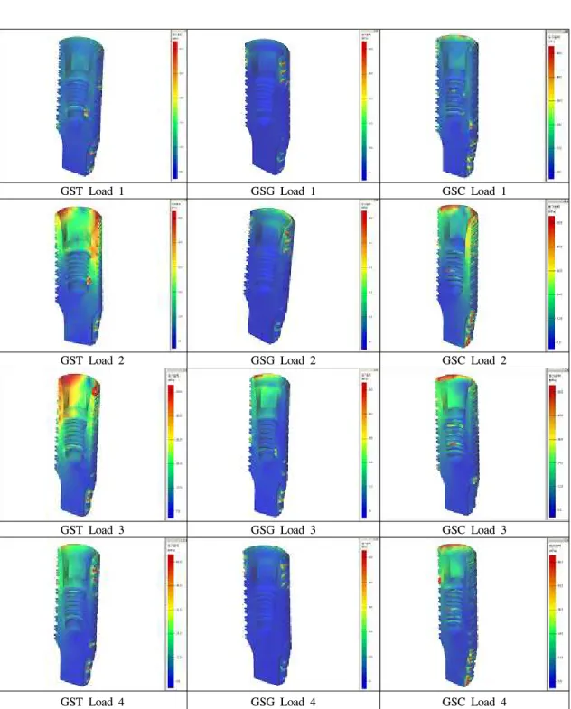 Fig. 11. The stress contours of the fixture in model under loading condition 1, 2, 3, 4.
