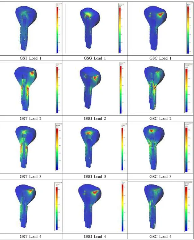 Fig. 3. The stress contours of model without bone under loading condition 1, 2, 3, 4.