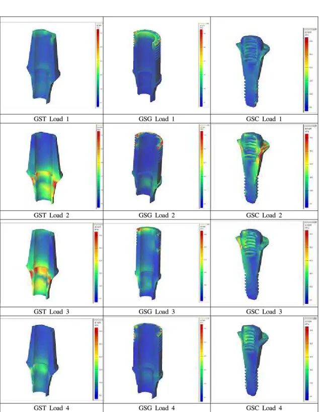 Fig. 9. The stress contours of the abutment in model under loading condition 1, 2, 3, 4.