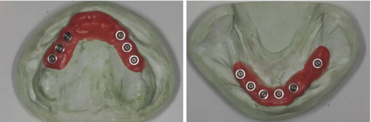 Fig. 13. Master casts were fabricated