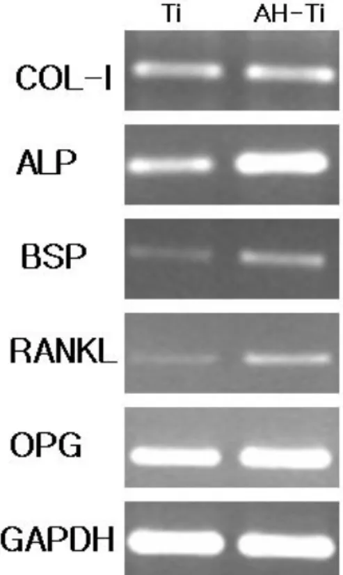 Fig. 8. Reverse transcription-polymerase chain reaction (RT-PCR) analysis of interleukin -6 (IL-6) and  glyceraldehyde-3-phosphate dehydrogenase (GAPDH) m RNA expression in rat calvarial cells (lane 1: control, lane 2; IL-1b (1 ng/ml), lane 3;SB203580+IL-1