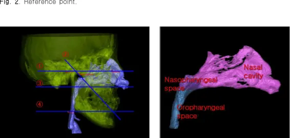 Fig. 3. Reference plane and nasal airway.