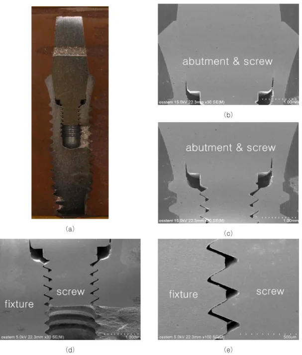 Fig. 8. Optical cross-sectional view (a) and SEM (b,c,d,e) of fixture/ abutment/screw connection in SS II implant system.