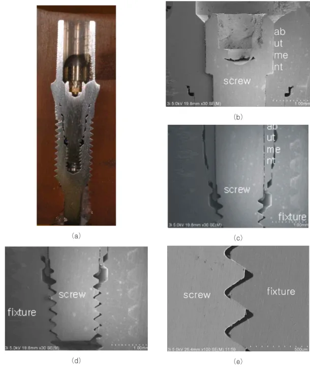 Fig. 4. Optical cross-sectional view (a) and SEM (b,c,d,e) of fixture/ abutment/screw connection in Certain implant system.