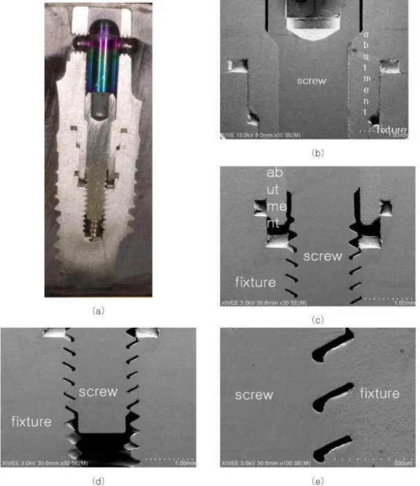 Fig. 5. Optical cross-sectional view (a) and SEM (b,c,d,e) of fixture/ abutment/screw connection in Xive implant system.
