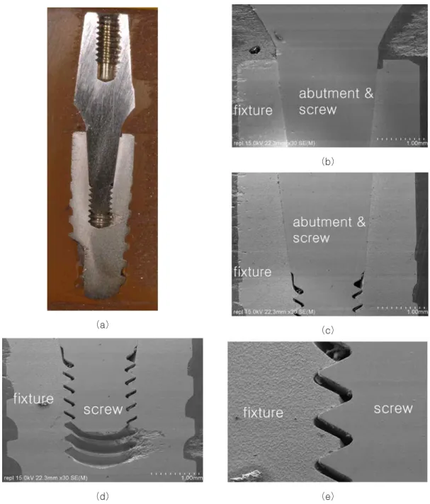 Fig. 7. Optical cross-sectional view (a) and SEM (b,c,d,e) of fixture/ abutment/screw connection in Ankylos implant system.