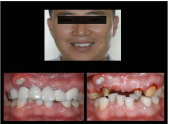 Fig. 1. Preoperative view.
