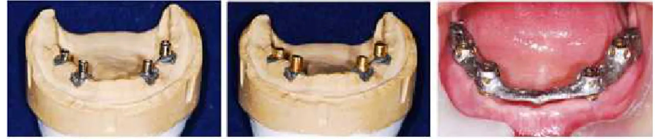 Fig. 7. 내관, 외관 및 금속 구조물.