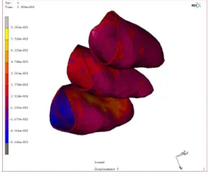 Fig. 24. 3D representation of Von Mises stress in the simple model (palatal view).