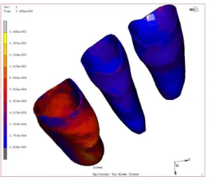 Fig. 25. 3D representation of Von Mises stress in the multi model (palatal view).