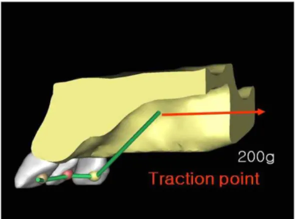 Fig. 4. Maxillary anterior teeth and traction arm were attached completely (occlusal view).