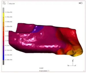 Fig. 9. 3D representation of displacement on Y direction in the multi model (occlusal view).