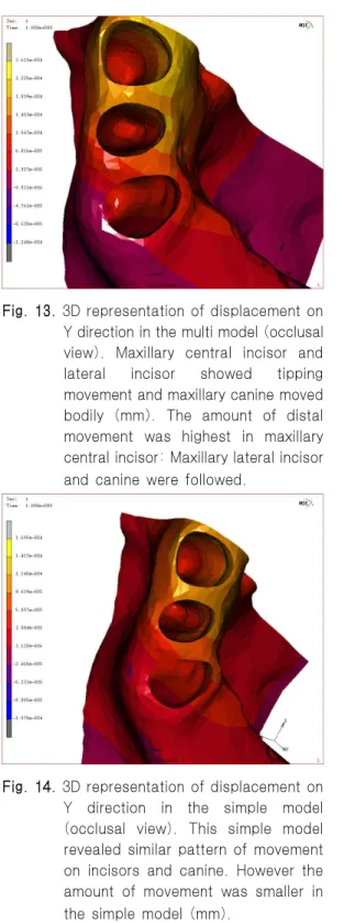 Fig. 15. 3D representation of displacement on Z direction in the multi model (lateral view).