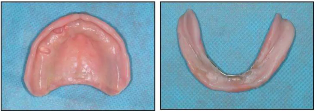 Fig. 8. 구의치의 조직면 첨상을 실시한 모습.