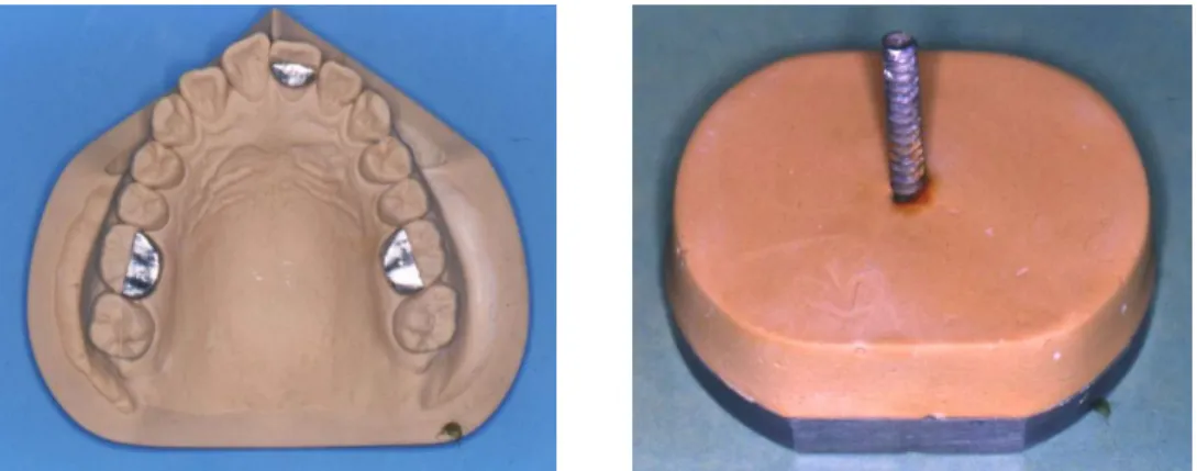 Fig. 1. Left: Master cast with three measuring points.