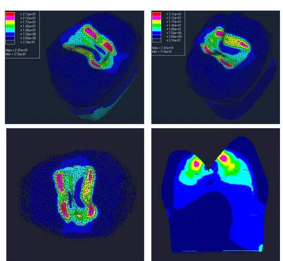 Fig. 9. von Mises stress of each reference points loaded at occlusal inclination of lingual cusp.