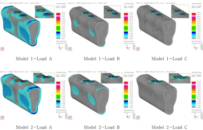 Fig. 5. The stress contour on bone of Model 1, 2 under loading condition A, B, C