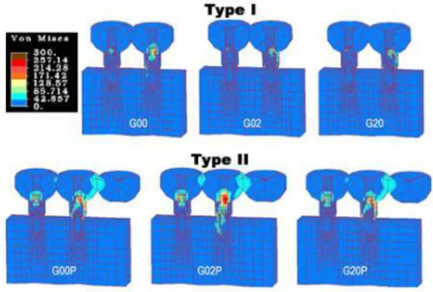 Fig. 3. Stress patterns in models of type I and II are demonstrated.