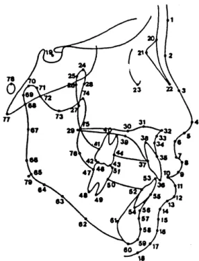 Table 1. Distribution of samples according to Angle's classification, age, and sex.
