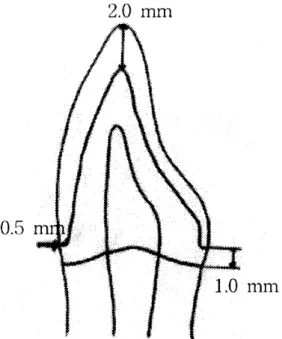 Fig. 1. Schematic presentation of tooth preparation