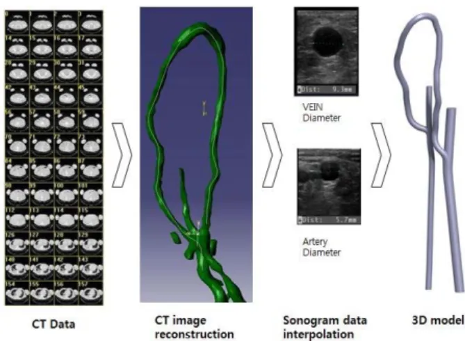 Fig. 1 End-to-Side Arteriovenous graft model 를  연구하였고  Salam et al.[15]은  내막증식  발생에  저  전단응 력이  고  전단응력보다  더욱  영향이  클  수  있음을  제시하였다