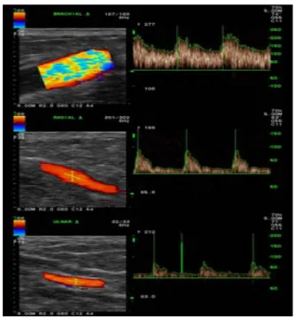 Fig. 5 Velocity profile at the arterial inlet