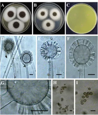 Fig. 3. Morphological description of Aspergillus tubingensis YH103  isolated from root of T
