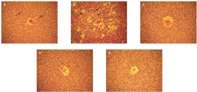 Fig. 3. Representative photographs of histopathological changes in the livers of rats